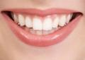 العنايه بالاسنان | تنظيف الاسنان | ابتسامة هوليوود |