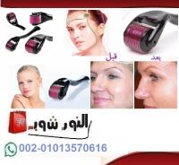 جهاز ديرما رولر ZGTS Derma Roller