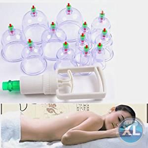 كاسات الحجامة الاسلامية تسليك الشرايين والاورده01283360296